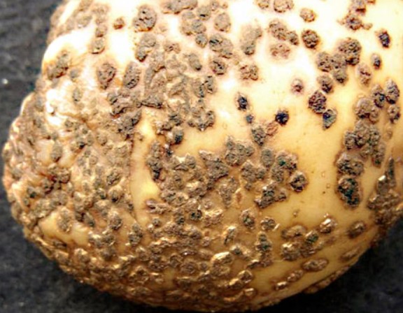 ΣΠΟΓΓΟΣΠΟΡΙΩΣΗ